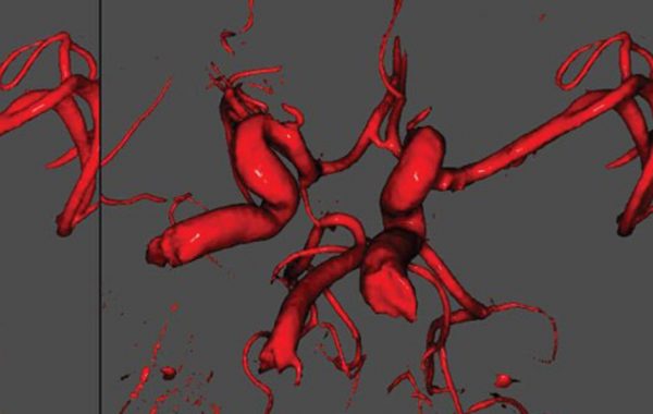 volumetric-visualisation